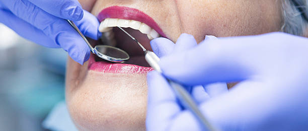 Best Emergency Dental Services for Seniors in Birmingham, AL